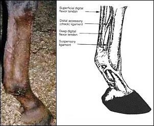 Tendon Health