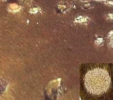 Horse Ringworm