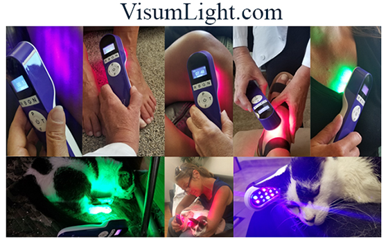 Visum Light Therapy