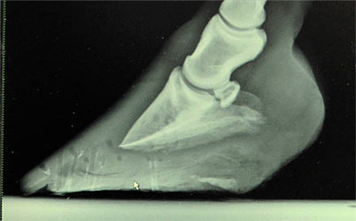 Laminitic hoof after Nolan Hoof Plates (15-week treatment period).